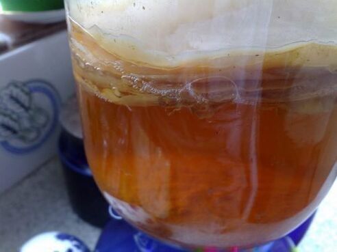 Infused kombucha from psoriasis