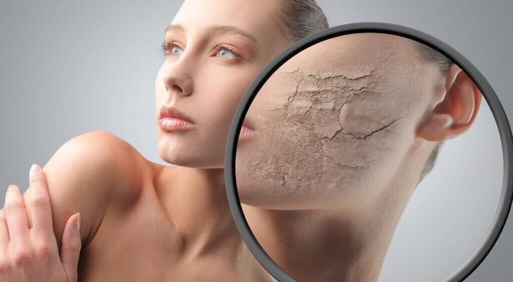 Skin damage
