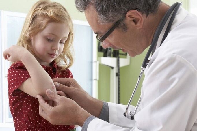 Suffering from psoriasis in early life